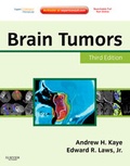 Cover: Brain Tumors - Churchill Livingstone