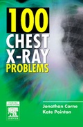 Cover: 100 Chest X-Ray Problems - Churchill Livingstone