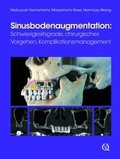 Cover: Sinusbodenaugmentation - Quintessenz Verlag