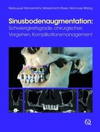 Enlarge image Cover: Sinusbodenaugmentation - Quintessenz Verlag