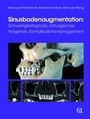 Cover: Sinusbodenaugmentation - Quintessenz Verlag