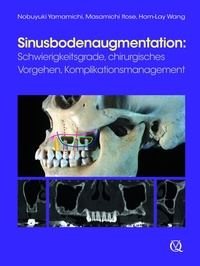 Abbildung von: Sinusbodenaugmentation - Quintessenz Verlag