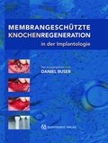 Cover: Membrangesch&uuml;tzte Knochenregeneration in der Implantologie - Quintessenz Verlag