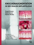 Cover: Augmentive Verfahren in der oralen Implantogie - Quintessenz Verlag