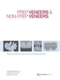 Abbildung von: Prep Veneers und Non-Prep Veneers - Quintessenz Verlag
