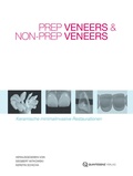 Cover: Prep Veneers und Non-Prep Veneers - Quintessenz Verlag