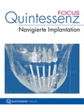 Cover: Quintessenz FOCUS Navigierte Implantation - Quintessenz Verlag