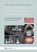 Cover: Sofortversorgung mit reduzierter Implantatanzahl - Quintessenz Verlag