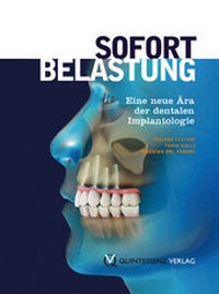 Abbildung von: Sofortbelastung - Quintessenz Verlag