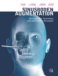 Cover: Sinusbodenaugmentation - Quintessenz Verlag