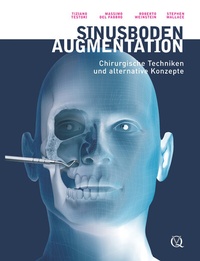 Abbildung von: Sinusbodenaugmentation - Quintessenz Verlag