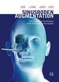 Cover: Sinusbodenaugmentation - Quintessenz Verlag