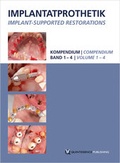 Cover: Implantatprothetik. DVD-Kompendium - Quintessenz Verlag