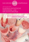 Cover: Plastisch-&Auml;sthetische Parodontal- und Implantatchirurgie - Quintessenz Verlag