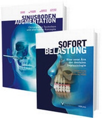 Abbildung von: Sinusbodenaugmentation und Sofortbelastung - Quintessenz Verlag