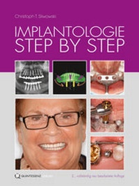 Abbildung von: Implantologie Step by Step - Quintessenz Verlag