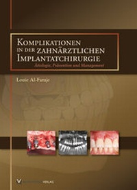 Abbildung von: Komplikationen in der zahnärztlichen Implantatchirurgie - Quintessenz Verlag
