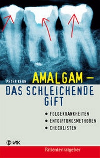 Enlarge image Cover: Amalgam - das schleichende Gift - VAK