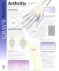 Cover: Arthritis - Churchill Livingstone