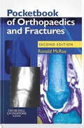Cover: Pocketbook of Orthopaedics and Fractures - Churchill Livingstone