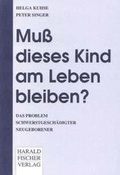 Cover: Mu&szlig; dieses Kind am Leben bleiben? - Fischer, Harald