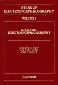 Abbildung von: Atlas of Electroencephalography: Neonatal Electroencephalography v. 1 - Elsevier