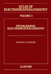 Abbildung von: Atlas of Electroencephalography: Intracranial Electroencephalography v. 3 - Elsevier