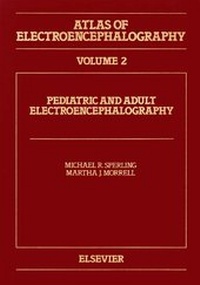 Abbildung von: Atlas of Electroencephalography: Pediatric and Adult Electroencephalography v. 2 - Elsevier