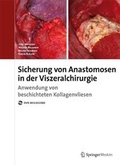 Cover: Anastomosensicherung in der Visceralchirurgie - Urban und Vogel