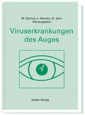 Cover: Viruserkrankungen des Auges - Kaden, R