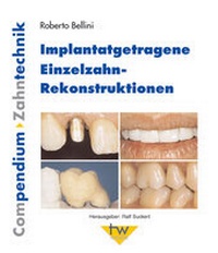Abbildung von: Implantatgetragene Einzelzahnrekonstruktionen - mgo fachverlage GmbH & Co. KG