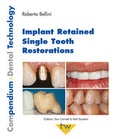 Cover: Implant Retained Single Tooth Restorations - mgo fachverlage