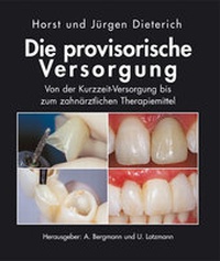 Abbildung von: Die provisorische Versorgung - mgo fachverlage GmbH & Co. KG