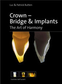 Enlarge image Cover: Crown, Bridge & Implants - mgo fachverlage