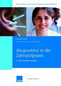 Abbildung von: Akupunktur in der Zahnarztpraxis - Spitta GmbH