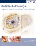 Cover: Bildatlas Lidchirurgie - KVM - Der Medizinverlag