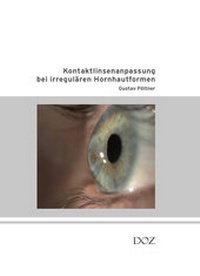 Abbildung von: Kontaktlinsenanpassung bei irregulären Hornhautformen - DOZ-Verlag Optische Fachveröffentlichung