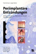 Cover: Periimplant&auml;re Entz&uuml;ndungen - Quintessenz Verlag