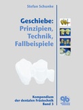 Cover: Geschiebe: Prinzipien, Technik, Fallbeispiele - Quintessenz Verlag