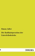 Cover: Die Radikaloperation der Unterleibsbr&uuml;che - DOGMA Verlag