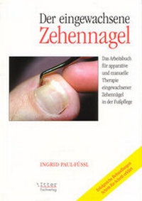 Abbildung von: Der eingewachsene Zehennagel - ITTER Fachverlag