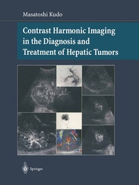 Abbildung von: Contrast Harmonic Imaging in the Diagnosis and Treatment of Hepatic Tumors - Springer