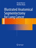 Bild: Illustrated Anatomical Segmentectomy for Lung Cancer - Springer
