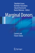 Abbildung von: Marginal Donors - Springer