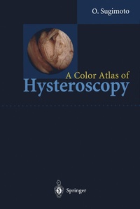 Abbildung von: A Color Atlas of Hysteroscopy - Springer