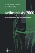 Cover: Arthroplasty 2000 - Springer