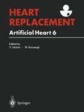 Cover: Heart Replacement - Springer
