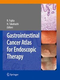 Abbildung von: Gastrointestinal Cancer Atlas for Endoscopic Therapy - Springer