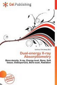 Abbildung von: Dual-Energy X-Ray Absorptiometry - Cel Publishing