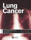 Cover: Lung Cancer - Wiley-Blackwell